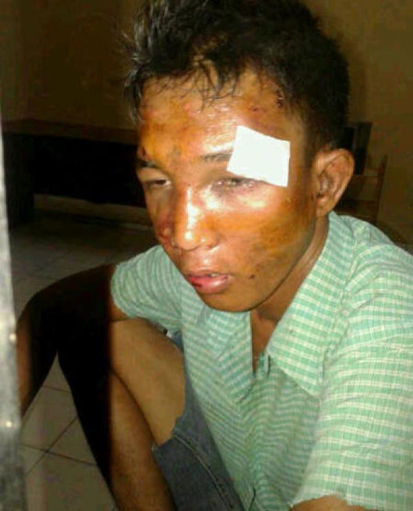 Sakit Hati Uang Tilang Tak Dibayar, Sandi Curi Cincin Anak Pacar Temannya