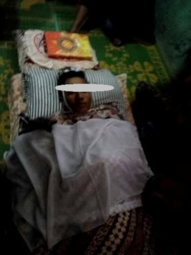 Ditombak Punggungnya Pakai Tojok Sawit, Dwi Hembuskan Nafas Terakhir
