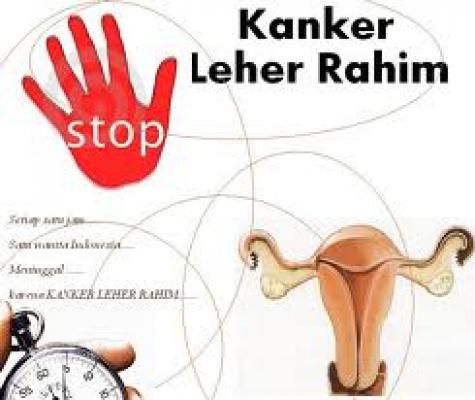 Kenali Gejala Kanker Serviks Sejak Dini