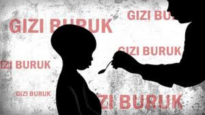 Masalah Gizi di Indonesia Jadi Faktor Penghambat Pembangunan Nasional