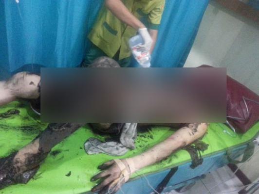 Isi Bensin Sambil Merokok, Pedagang Bensin Eceran Terbakar